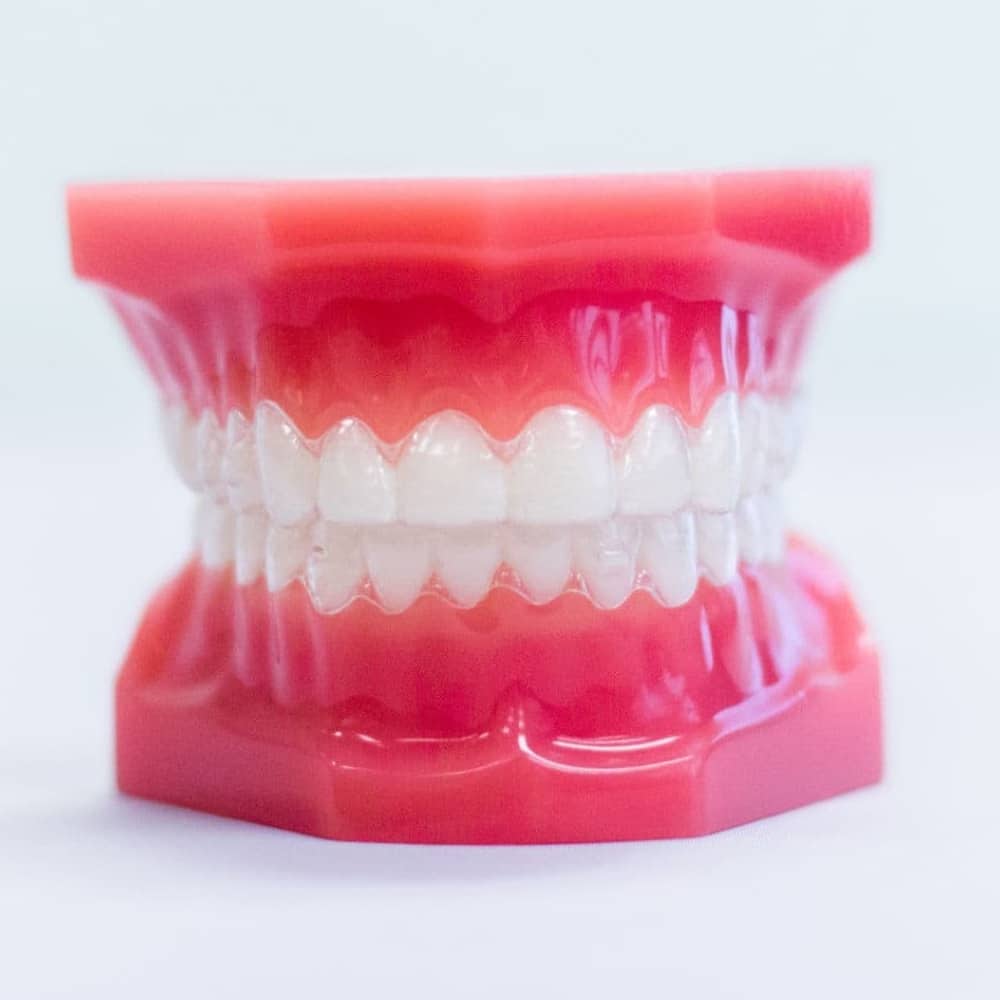 invisalign aligners on model