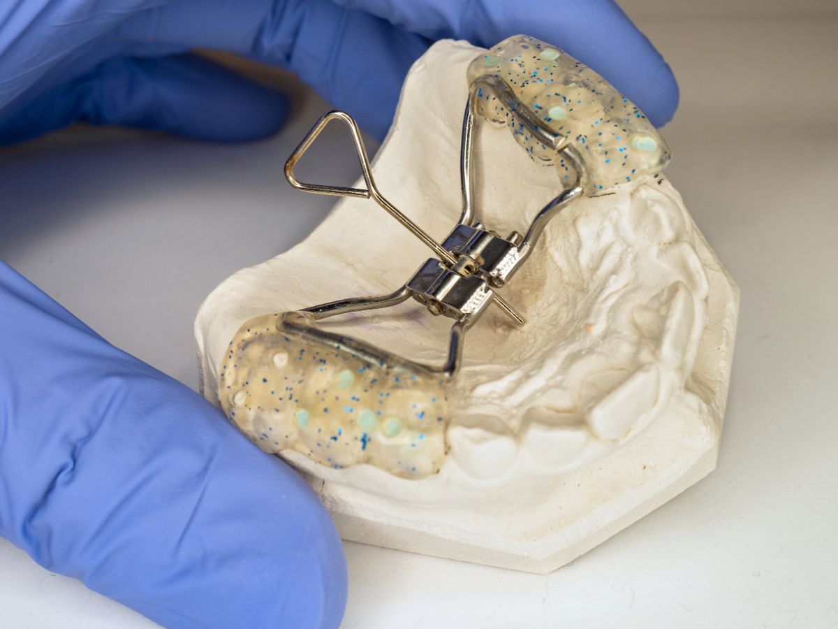 Everything You Need to Know About Palatal Expanders in Orthodontics -  Family Braces