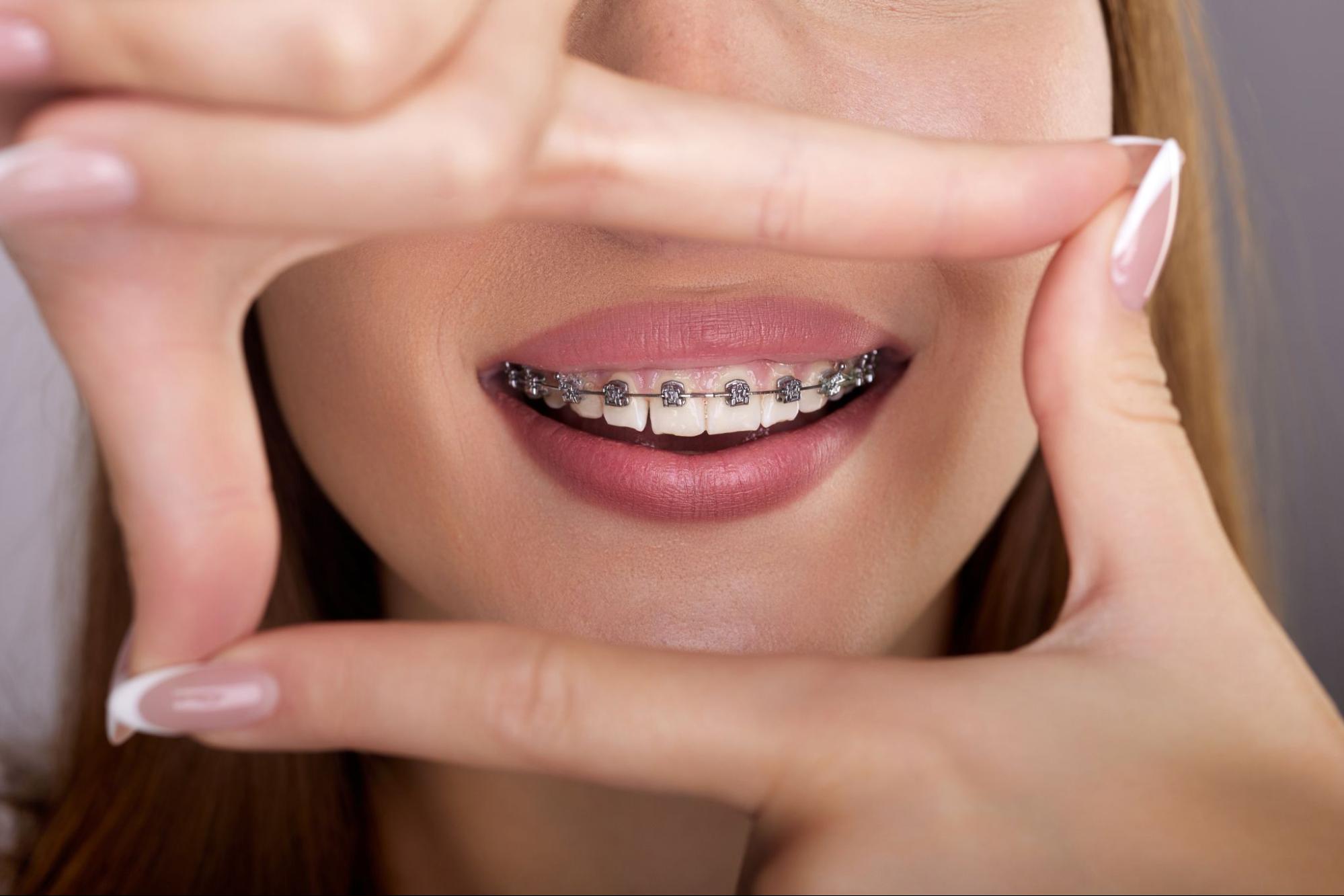 How Orthodontics Can Help Teens Feel Great